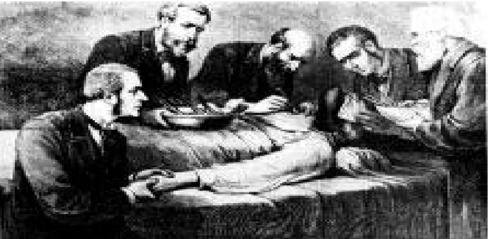 Figure 8 : Le dessin de la tumeur du prince Frederick de Hohenzollren par MorellMackensie lors  de l’examen clinique des 20 et 21 mai 1887