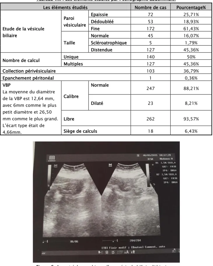Tableau VIII : Les éléments étudiés par l’échographie abdominale. 