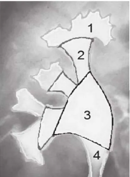 Figure 14 : Caractéristiques anatomique des cavités rénales :  1- Calice mineurs  2- calices majeurs  3 - pelvis rénal  4- uretère  1.1