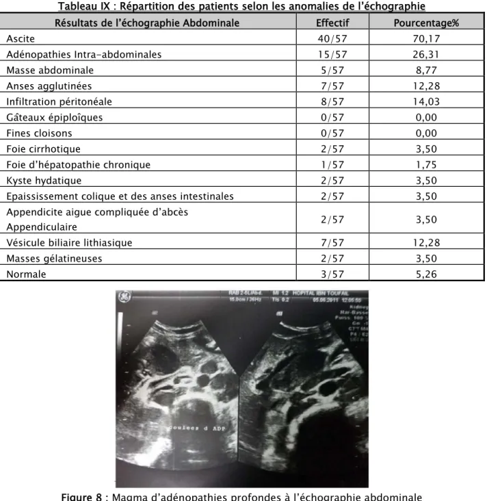 Tableau IX : Répartition des patients selon les anomalies de l’échographie  Résultats de l’échographie Abdominale  Effectif  Pourcentage% 
