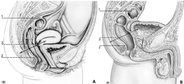 Figure 26 : (A). Coupe sagittale du petit bassin chez la femme. (B). Coupe sagittale du petit bassin  chez l’homme.1