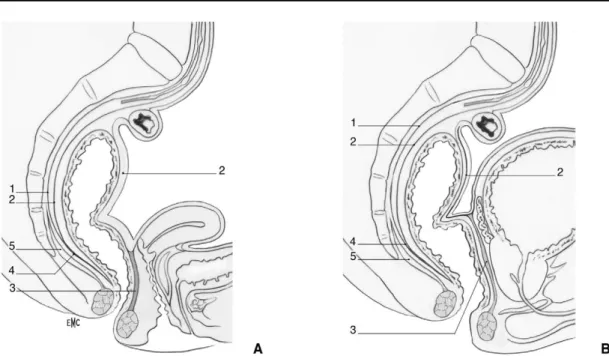 Figure 30 : Coupe sagittale du petit bassin : (A). chez la femme. 1. Feuillet pariétal du fascia 