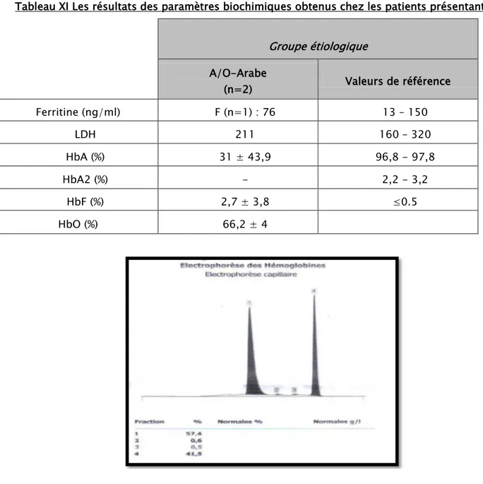 Tableau XI Les résultats des paramètres biochimiques obtenus chez les patients présentant  une hémoglobinopathie O-Arabe