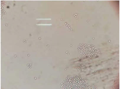 Figure 4 : Présence de tubes germinatifs permettant d’identifier l’espèce Candida albicans