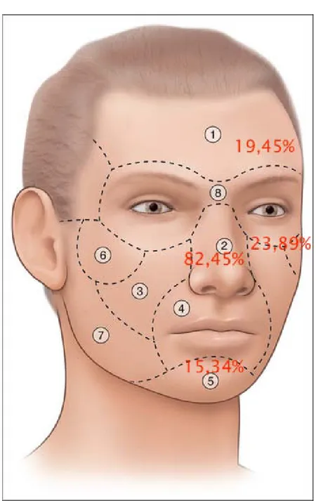 Figure 8 : Siège des plaies par unités et sous unités esthétiques de la face. 