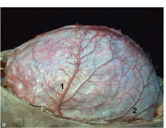 Figure 11: Vue latérale gauche de l’encéphale montrant les branches de l’artère méningée  moyenne.1) Branche frontale 2) Branche pariétale [24]