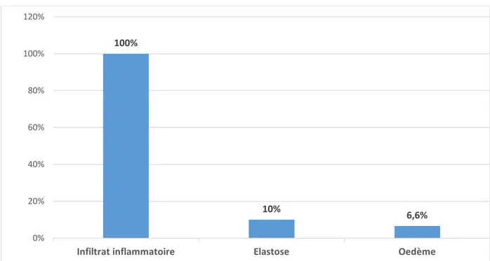 Figure 13 : Répartition des lésions dermiques chez nos malades ayant LEC discoïde 100% 10% 6,6% 0% 20% 40% 60% 80% 100% 120% 