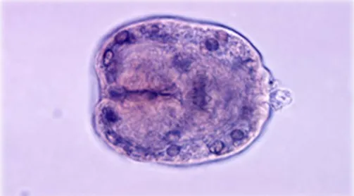 Figure 20 : Aspect microscopique (protoscolex) [89]   Il n’est pas fait en pratique courante