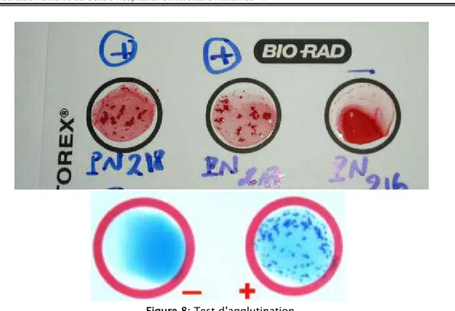 Figure 8: Test d’agglutination  