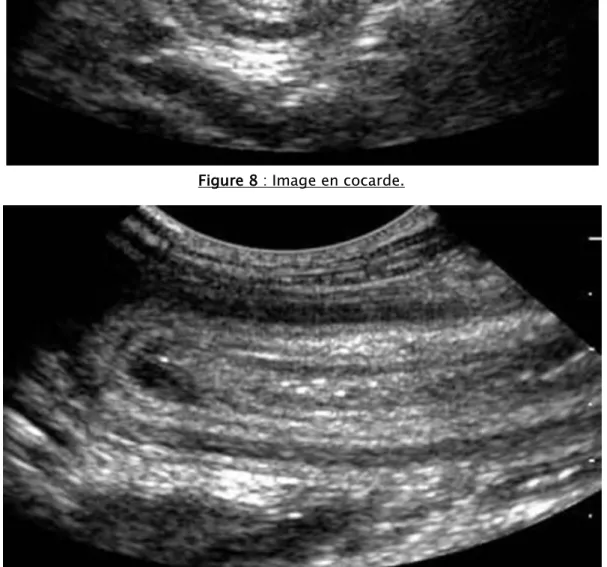 Figure 9 : Image en sandwich. 