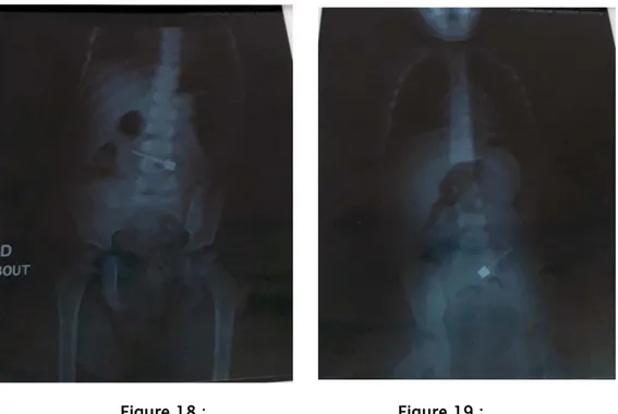 Figure 18 :                                     Figure 19 : 