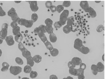 Figure 10 : Frottis sanguin montrant une agglutination des plaquettes.  2.  Temps de saignement 