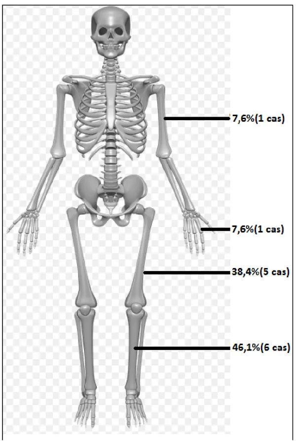 Figure 5: Schéma montrant la répartition des localisations au niveau du squelette. 