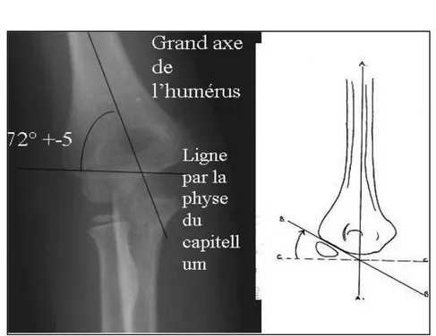 Figure 34: Radiographie du coude de face et schéma montrant l’angle de Baumann(33) 