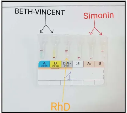 Figure 1 : Carte gel ABO (méthode de Beth-Vincent et Simonin) 