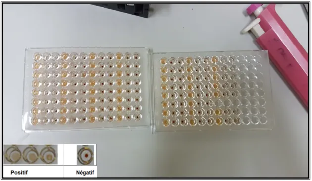 Figure 10 : Test de TPHA en microplaque 