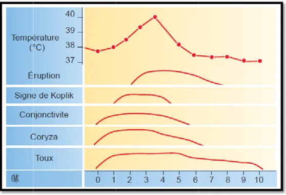 Figure 23 :  heure (Figu nterne des  6, qui porte  léments bla e variable e e sur la sér s paupièresbie  ue, pénible, gée