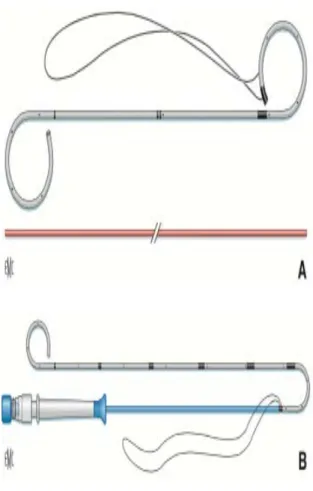 Figure 12: Types de sondes double J (9) 
