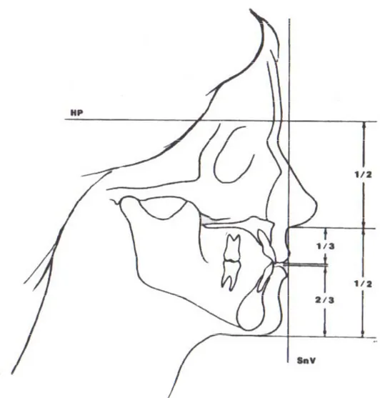 Figure 6 : Critères céphalométriques pour l’évaluation des proportions faciales verticales  (Bell et al., 1986)