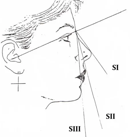 Figure 7: Les angles d’Achard et Blanc (Mouakke,1988) 