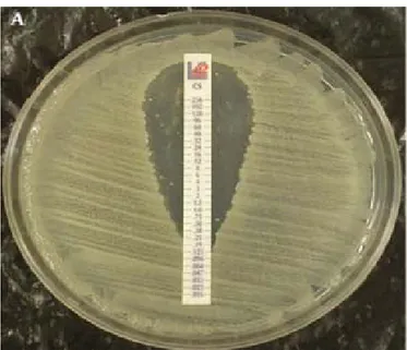 Figure 2 : CMI d’A.baumannii sensible à la colistine. 