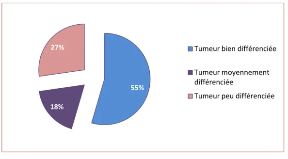 Figure 13 : Différenciation tumorale des pièces de DPC. 55%