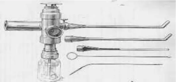 Figure 14 :L’endoscope de Desormeaux. 
