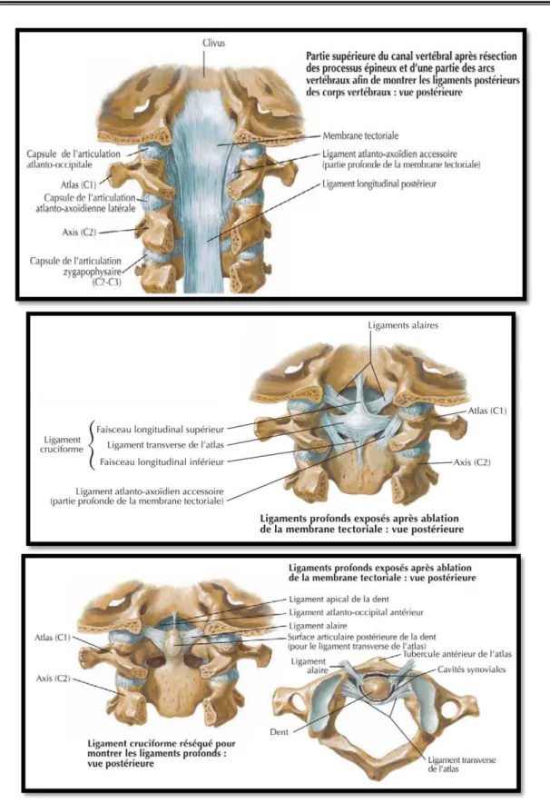 Figure 11: vue postérieure de la charnière cervico-occipitale après ablation des lames  vertébrales