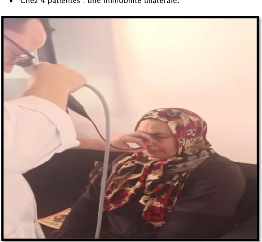 Figure 8: Nasofibroscopie photo du service ORL CHU Mohamed VI    Examen cervical : 
