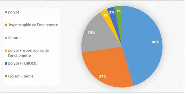 Figure 21: répartition des causes du saignement menstruel anormal  trouvées a l'hysteroscopie 