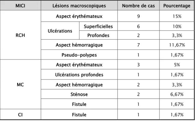 Tableau XIII : Résultat de la rectoscopie réalisée chez nos patients 