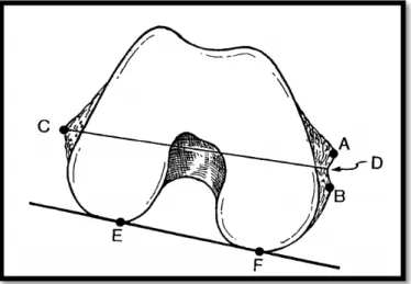 Figure 6 : A=berge supérieure du sulcus, B=berge inférieure du sulcus, C=sommet de  l’épicondyle latéral, D=centre du sulcus  