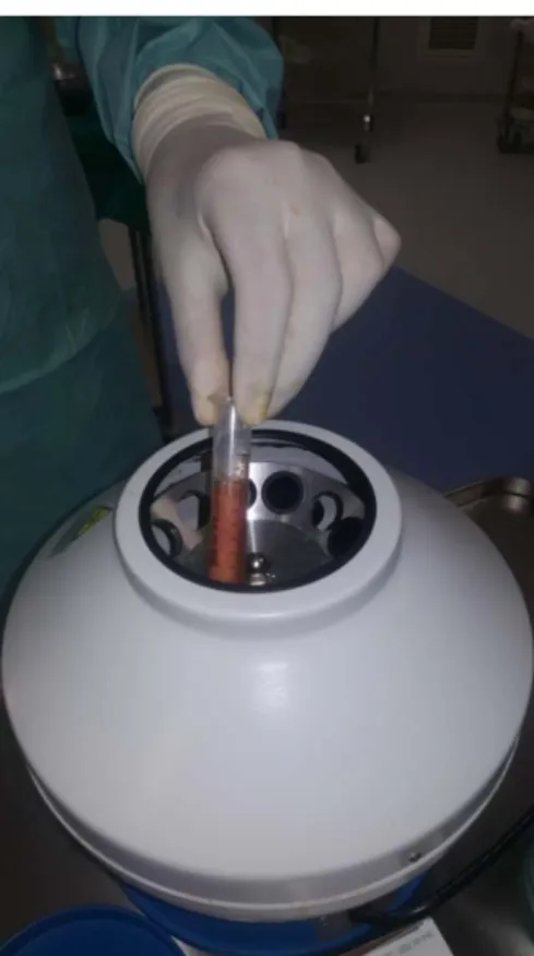 Figure 19 : Mise en place du tissu adipeux prélevé dans une centrifugeuse REGENLAB 