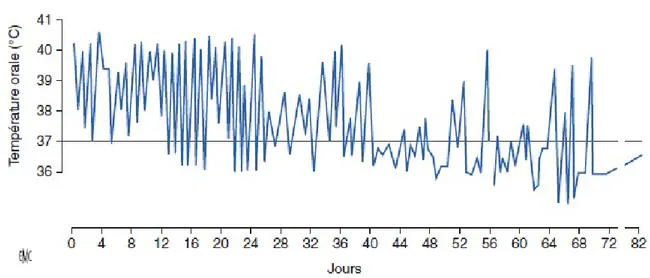 Figure 15    : Courbe  thermique typique  d’une  maladie de  Still de l’adulte. Fièvre intermittente avec retour  à l’apyrexie entre les pics fébriles quotidiens [25]