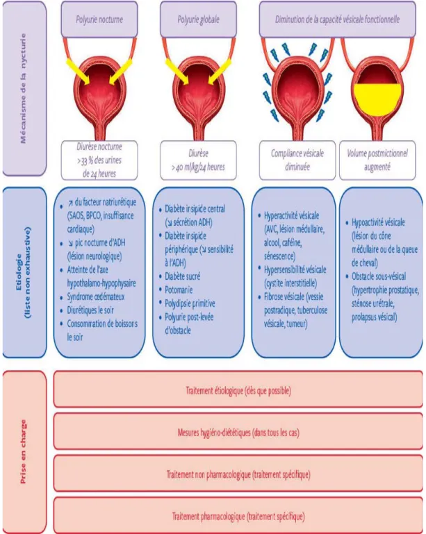 Figure 1 : Présentation des différentes causes de la  nycturie et stratégie de prise en charge 