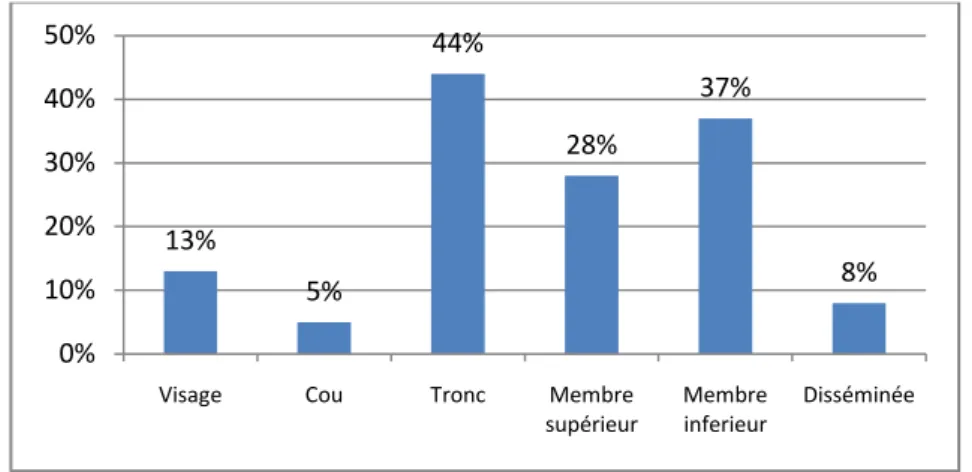 Figure 04 :  Localisation du mycoosis fongoide . 