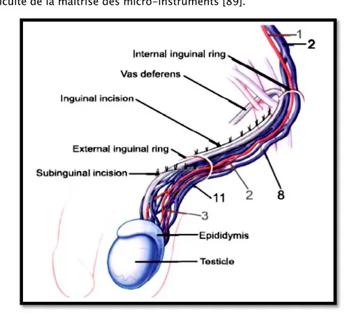 Figure 26: schéma anatomique du cordon spermatique : montrant les différentes structures  artérielles (rouge) et veineuses (bleu) et leur nombre selon le niveau indiqué 