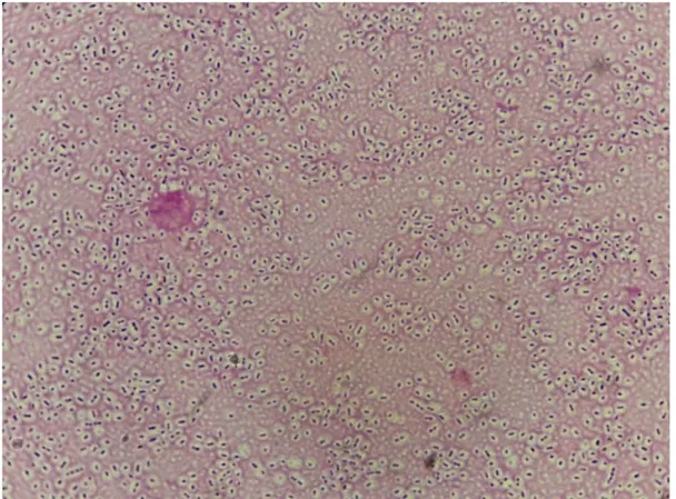 Figure 3: Encapsulated Gram-positive diplococci  b.  Search for hemolysis 