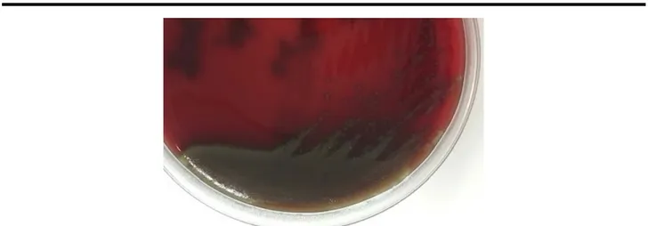 Figure 4:  Streptococcus pneumoniae  colonies surrounded by a greenish halo on blood agar, 