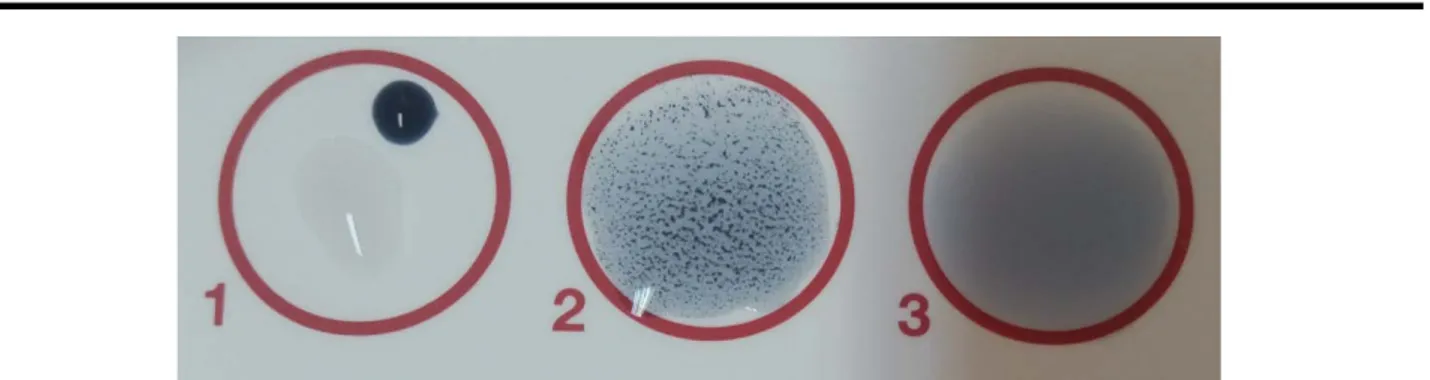 Figure 8: 1) A drop of the reagent + a drop of PBS (Phosphate Buffered Saline), 2) Positive  agglutination aspect, 3) Negative agglutination aspect 