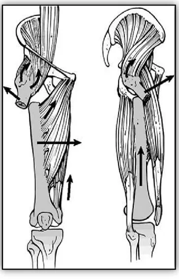 FIGURE 15 : Schéma montrant la déformation caractéristique d’une fracture sous trochantérienne