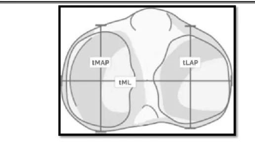 Figure 5 : Schéma représentatif de tMAP, tLAP et tML sur une coupe axiale [89].  c.  Rayons de courbure[1,28]: 