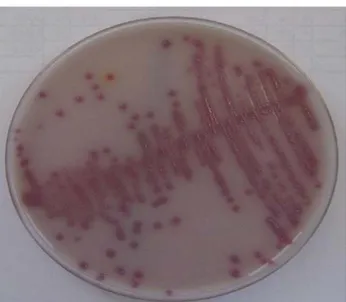 Figure 2  :  Escherichia coli  sur milieu chromogène UriSELECT [5] 
