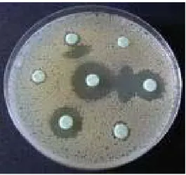 Figure 4 : Aspect de bouchon de champagne d'une bêta-lactamase. 