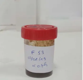 Figure 1 : Exemple d’un échantillon de selles recueilli lors de notre travail  (Laboratoire de parasitologie-mycologie de l’Hôpital Militaire Avicenne de Marrakech) 