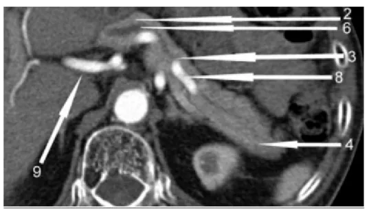 Figure 19 : Coupe tomodensitométrique transversale de l’abdomen après injection d’iode à  un temps artériel passant par T12 [179]