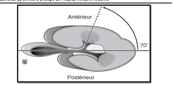 Figure 10 : Rein selon Brödel. De face, sur urographie intraveineuse, Les calices postérieurs  sont en dehors