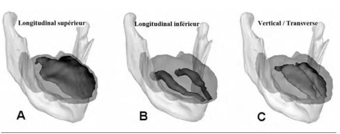 Figure 16 Configuration spatiale des muscles linguaux intrinsèque  b.  Les muscles extrinsèques 