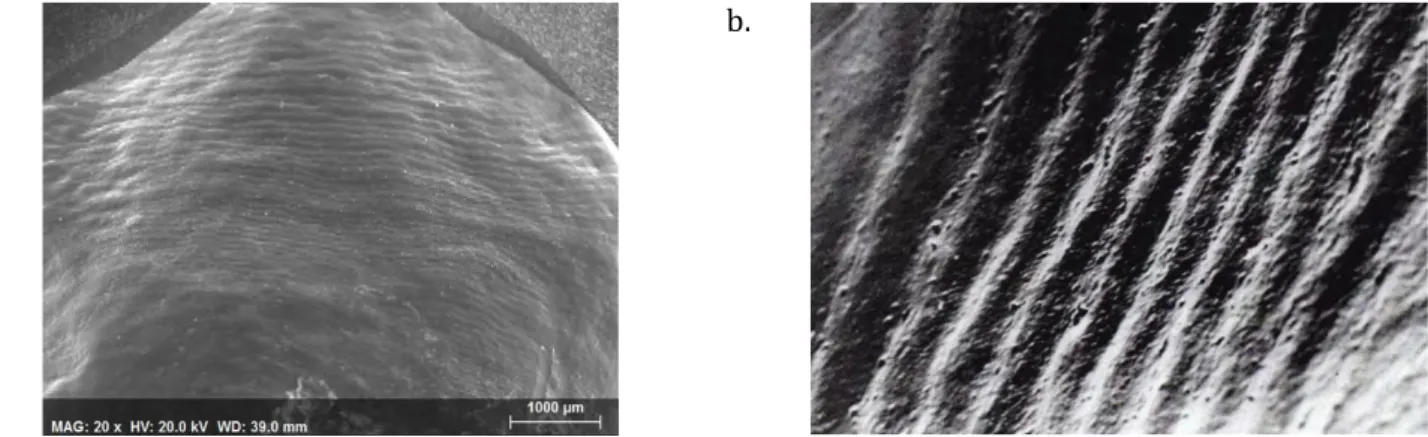 Figure	
  2	
  :	
  a.	
  Périkématies	
  (surface	
  vestibulaire,	
  grossissement	
  x20	
  au	
  Microscope	
  Electronique	
  à	
  Balayage	
   MEB)	
  Cliché	
  Personnel	
  (CP),	
  b.	
  Périkématies	
  selon	
  Kaqueler	
  (7)	
  