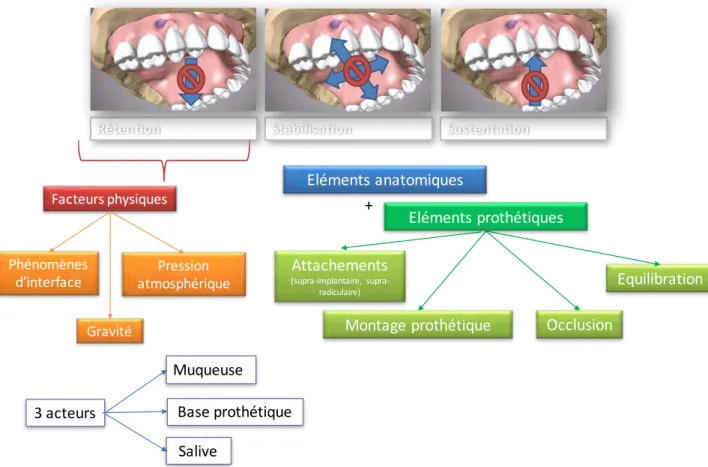 Fig	1:	Eléments	de	Maintien	d’une	Prothèse	Amovible	